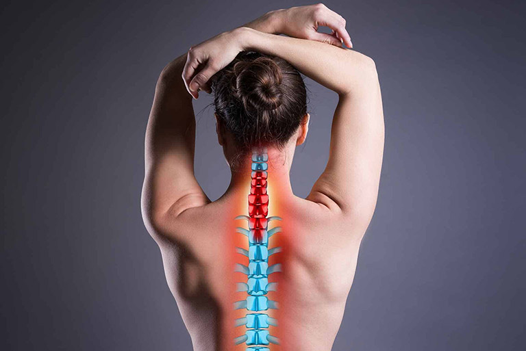 Bị Thoát Vị Đĩa Đệm Có Nên Đi Bộ Không?