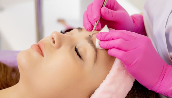 Tuổi Dậy Thì  Spa Nặn Mụn - Nên Hay Không Nên?