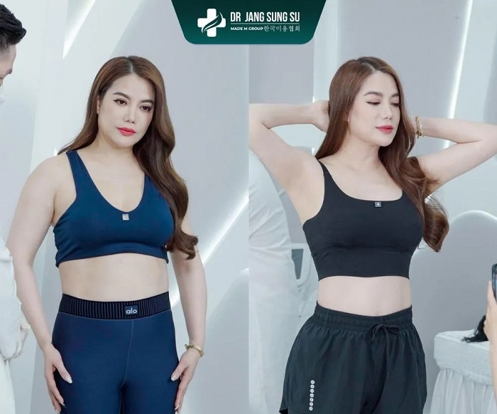 Từng liệu trình sẽ có mức giá phù hợp